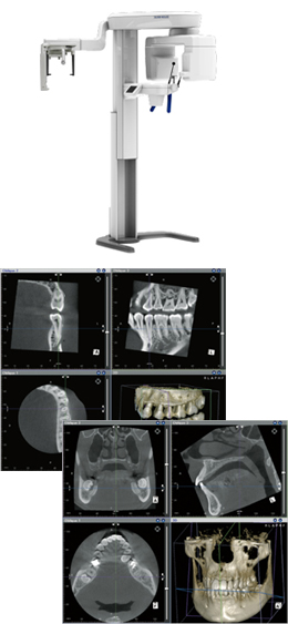X線CT診断装置セファロ撮影モデル