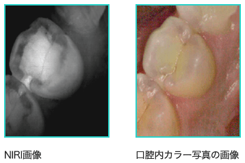 NIRI技術の特徴