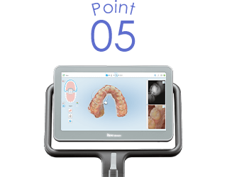 デジタル印象採得装置によるむし歯の検知が可能